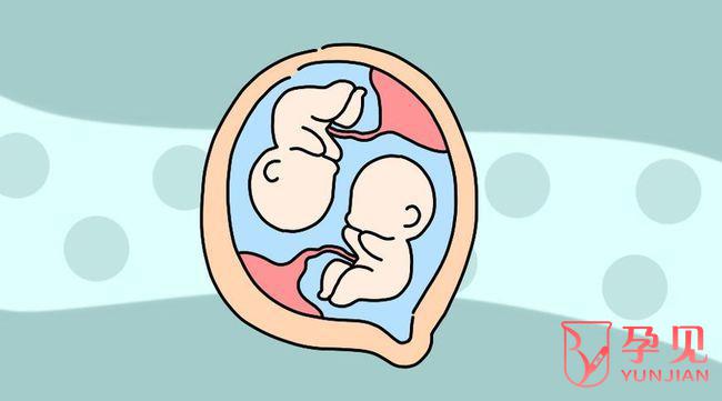 有多囊卵巢综合征是不是更容易怀双胞胎