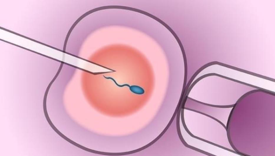 人工周期移植冻胚