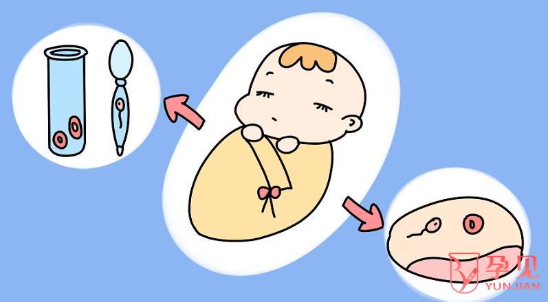 南京捐卵试管婴儿费用