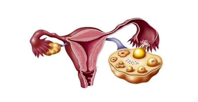 卵巢早衰的主要原因是什么