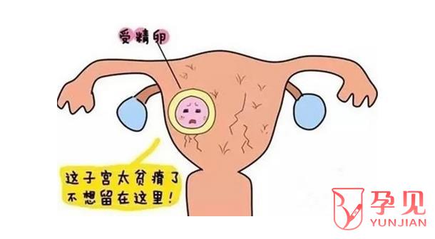 输卵管积水会导致生化妊娠吗