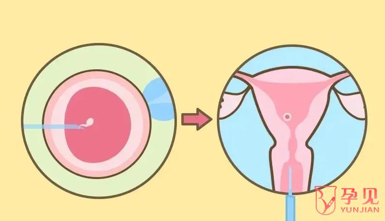 胚胎移植着床有什么症状或感觉