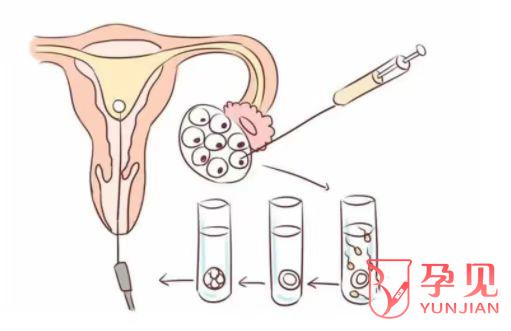 卵巢早衰试管婴儿成功率是多少