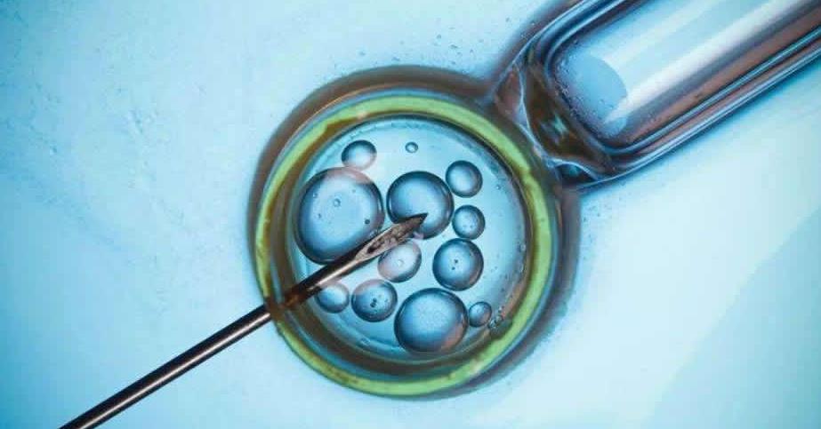 卵巢早衰试管一般定什么方案
