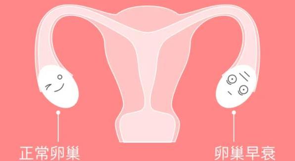 卵巢早衰的病因有哪些