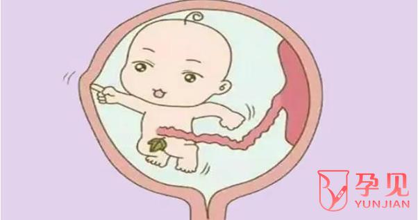 单角子宫影响胎儿发育吗