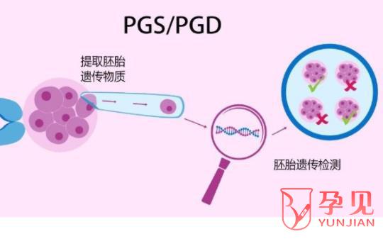 囊胚pgs/pgd