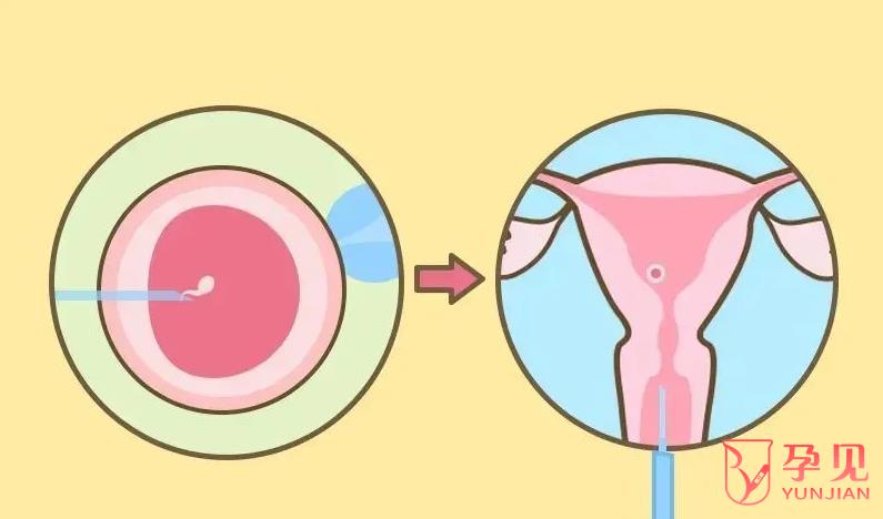胚胎植入是在什么时期进行