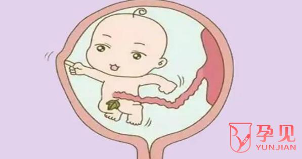 双子宫的人能正常生育吗
