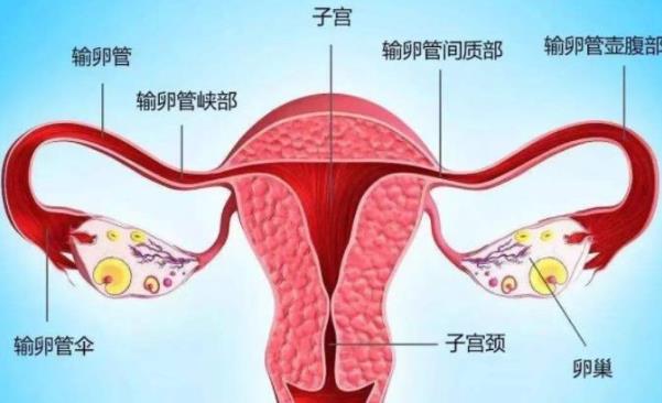 多囊卵巢综合征会导致输卵管堵塞吗