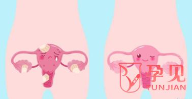 卵巢早衰怀孕了孩子能保住吗