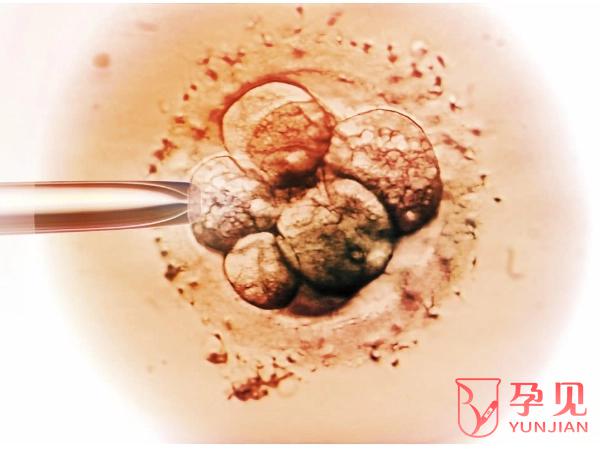 囊胚质量
