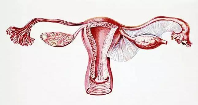 宫腔粘连会导致输卵管堵塞吗