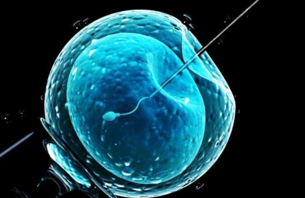 多囊卵巢综合征需要做试管婴儿吗